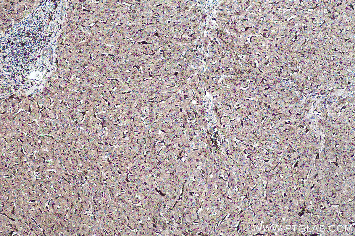 Immunohistochemical analysis of paraffin-embedded human liver tissue slide using KHC0429 (IFI30 IHC Kit).