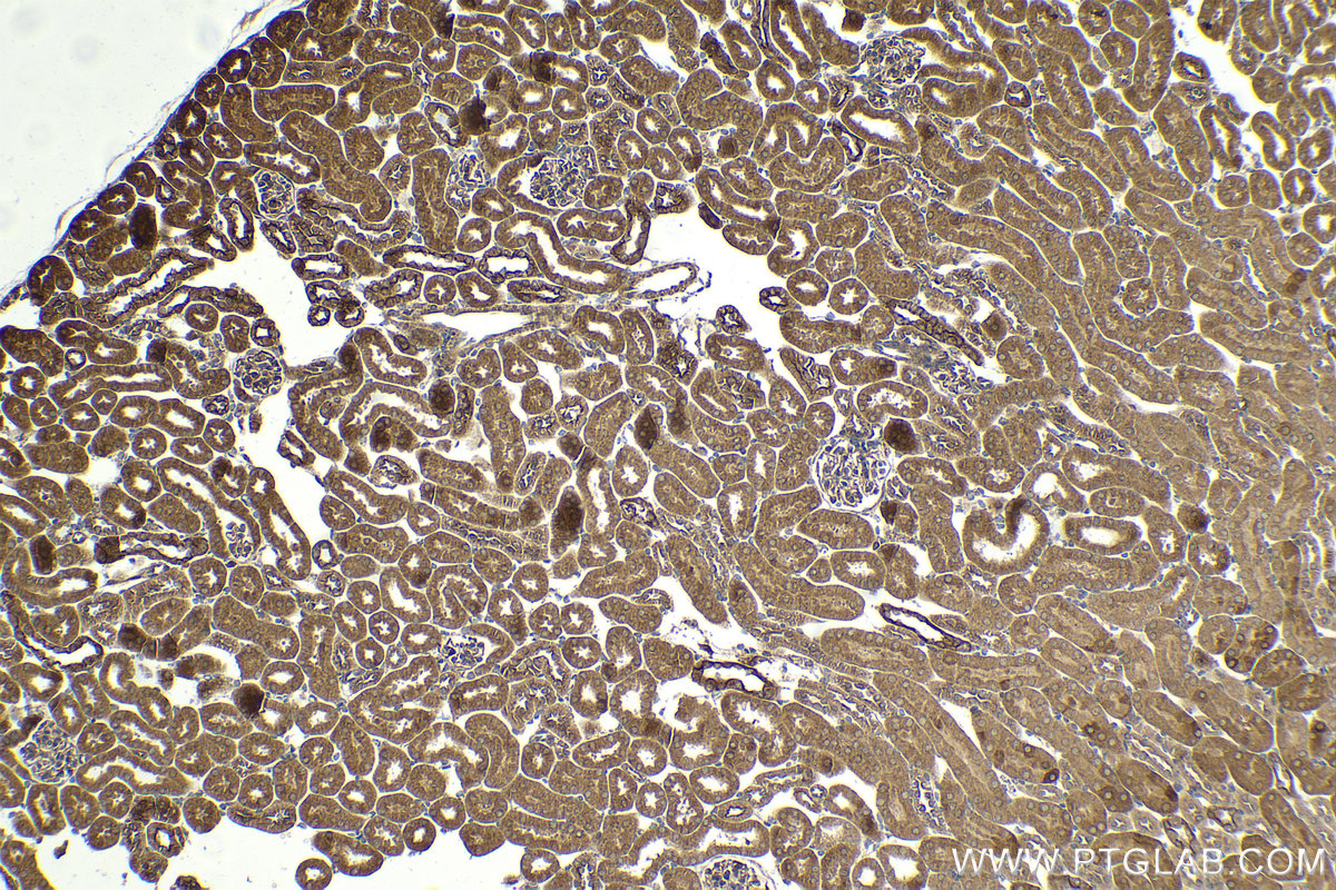 Immunohistochemical analysis of paraffin-embedded mouse kidney tissue slide using KHC2059 (IFIT3 IHC Kit).