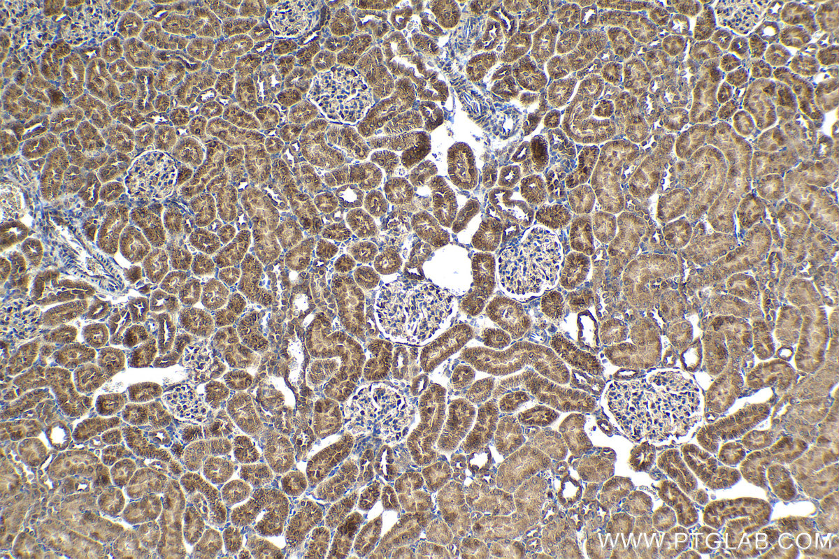 Immunohistochemical analysis of paraffin-embedded rat kidney tissue slide using KHC2059 (IFIT3 IHC Kit).