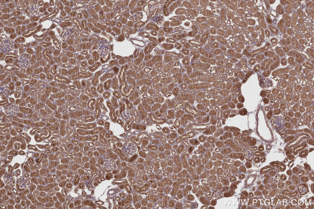 Immunohistochemical analysis of paraffin-embedded mouse kidney tissue slide using KHC2806 (IFT74 IHC Kit). Immunohistochemical analysis of paraffin-embedded mouse kidney tissue slide using KHC2806 (IFT74 IHC Kit).
