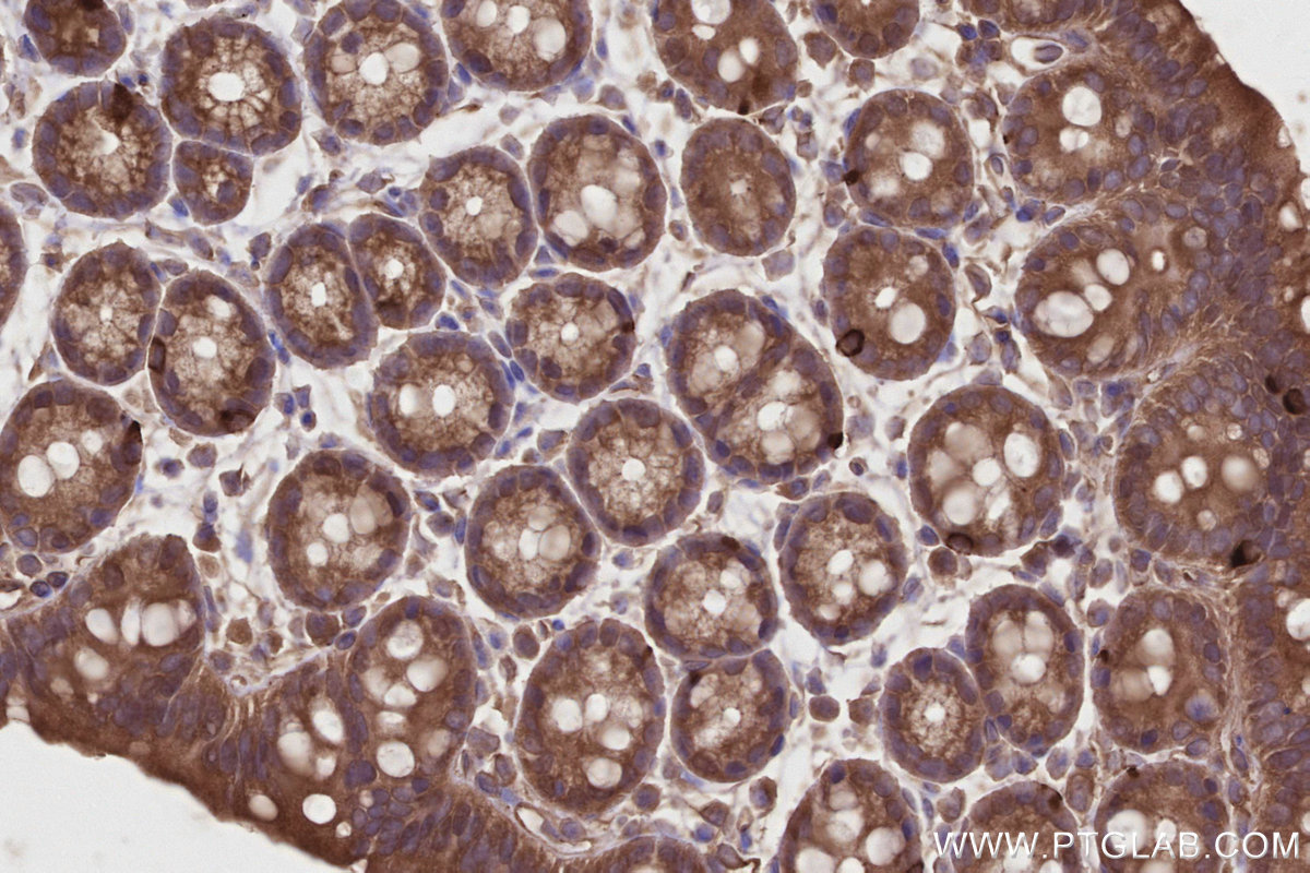 Immunohistochemical analysis of paraffin-embedded mouse colon tissue slide using KHC2806 (IFT74 IHC Kit). Immunohistochemical analysis of paraffin-embedded mouse colon tissue slide using KHC2806 (IFT74 IHC Kit).