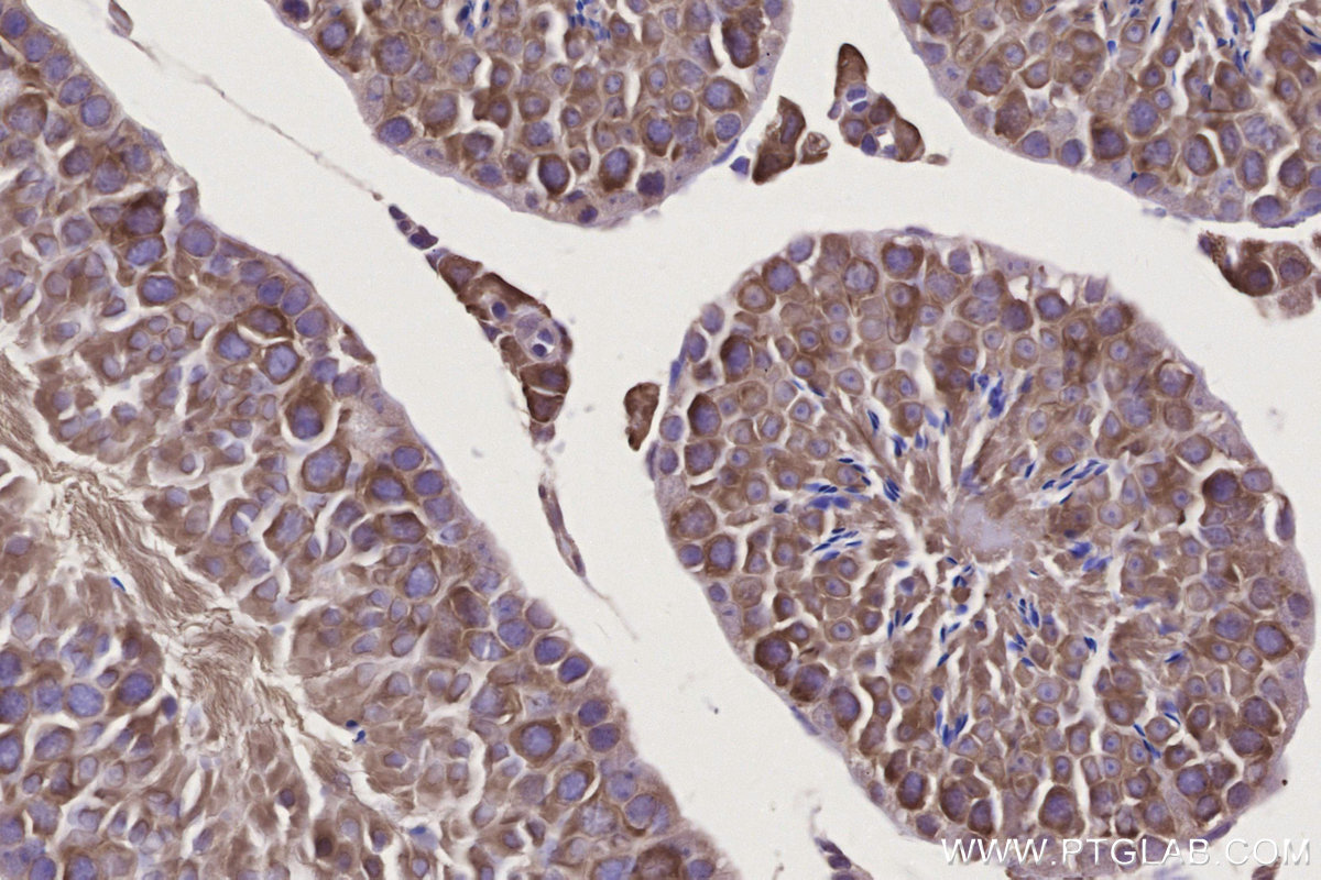 Immunohistochemical analysis of paraffin-embedded mouse testis tissue slide using KHC2806 (IFT74 IHC Kit). Immunohistochemical analysis of paraffin-embedded mouse testis tissue slide using KHC2806 (IFT74 IHC Kit).