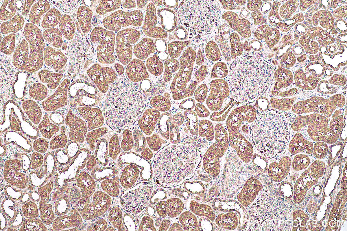 Immunohistochemical analysis of paraffin-embedded human kidney tissue slide using KHC0737 (IGF1R IHC Kit).