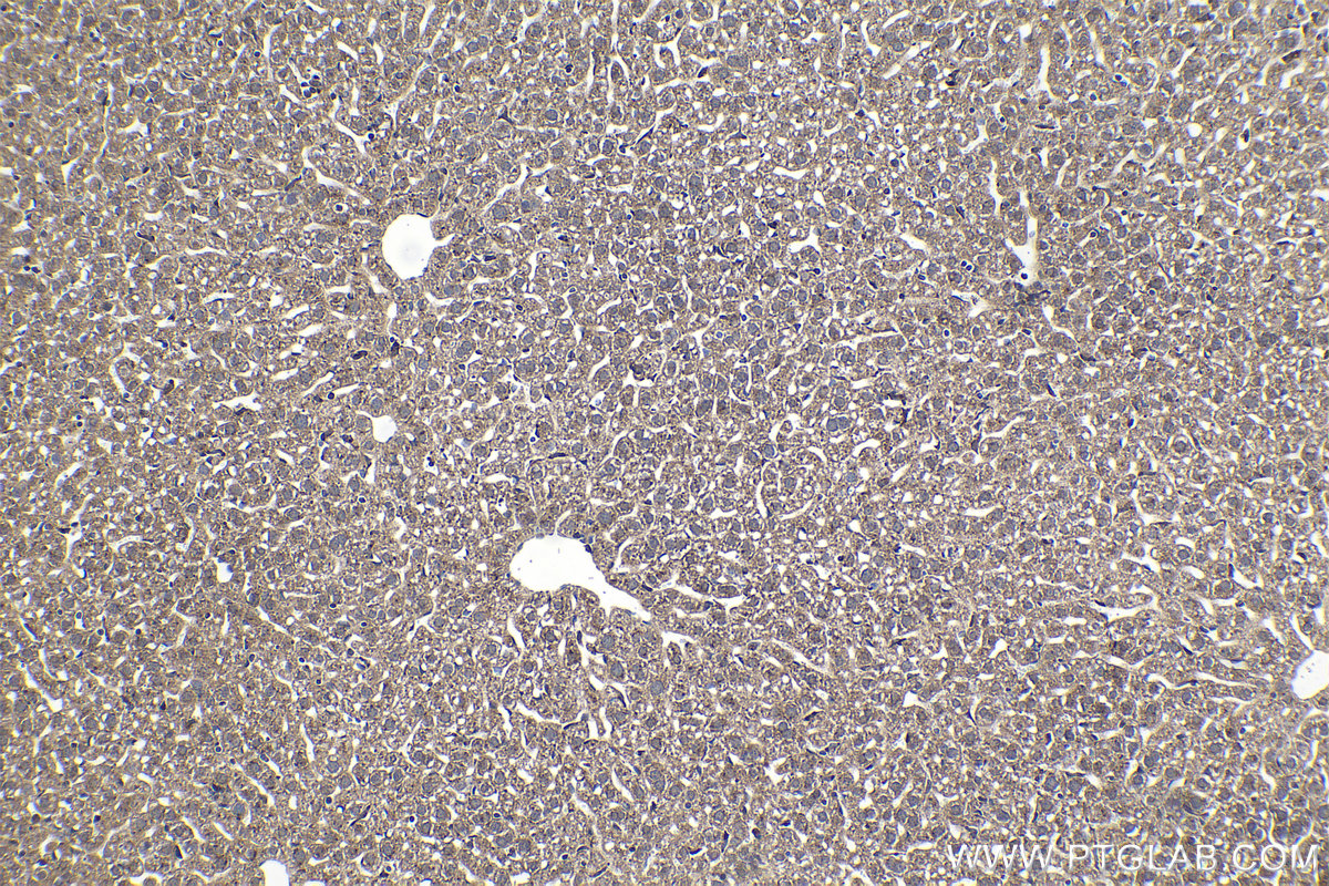 Immunohistochemical analysis of paraffin-embedded mouse liver tissue slide using KHC1361 (IGF2R-Specific IHC Kit).