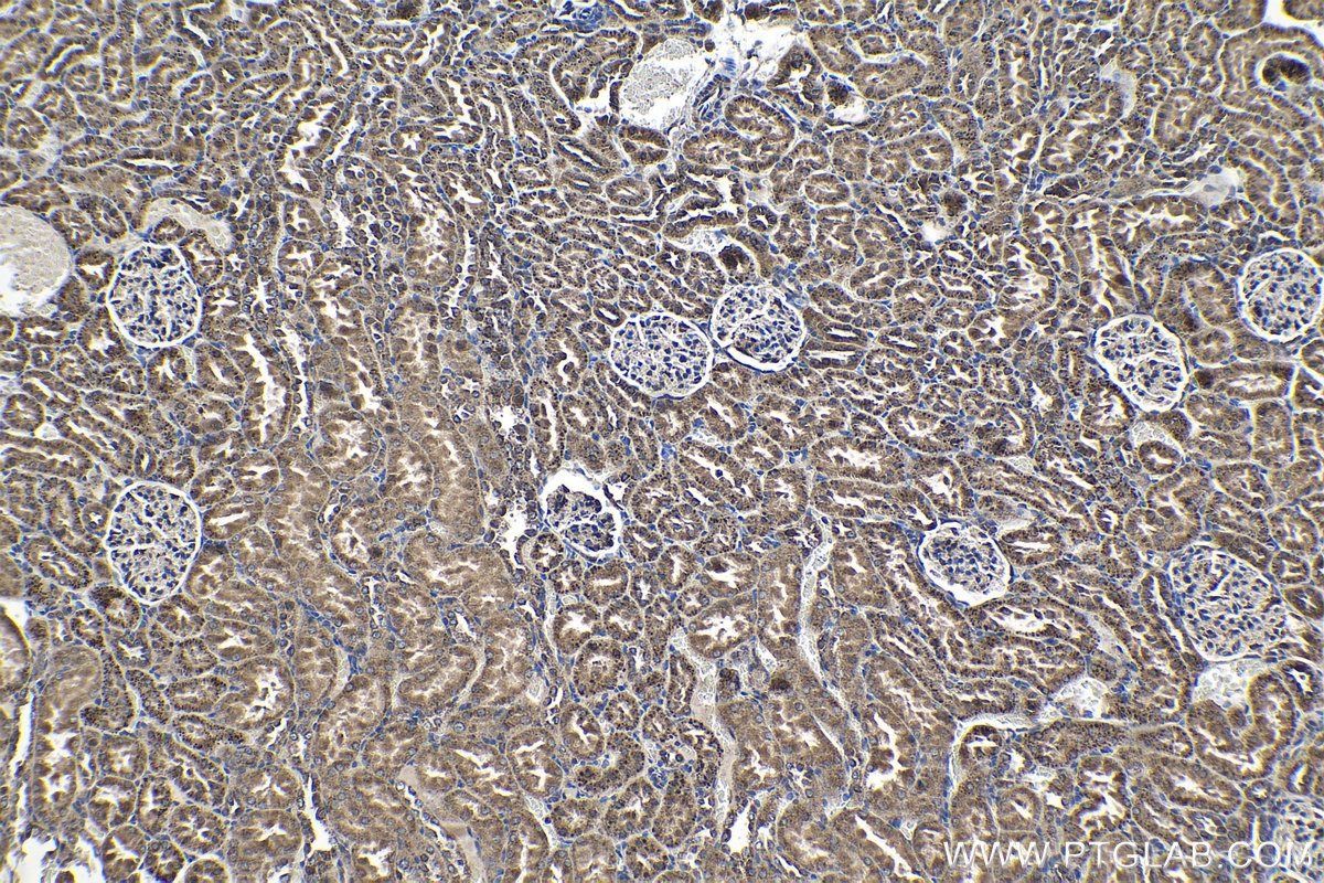 Immunohistochemical analysis of paraffin-embedded rat kidney tissue slide using KHC1361 (IGF2R-Specific IHC Kit).