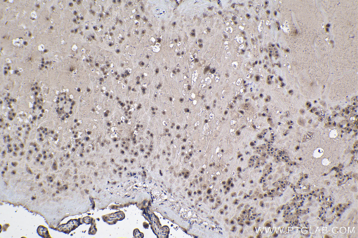 Immunohistochemical analysis of paraffin-embedded human placenta tissue slide using KHC1088 (IGFBP1 IHC Kit).