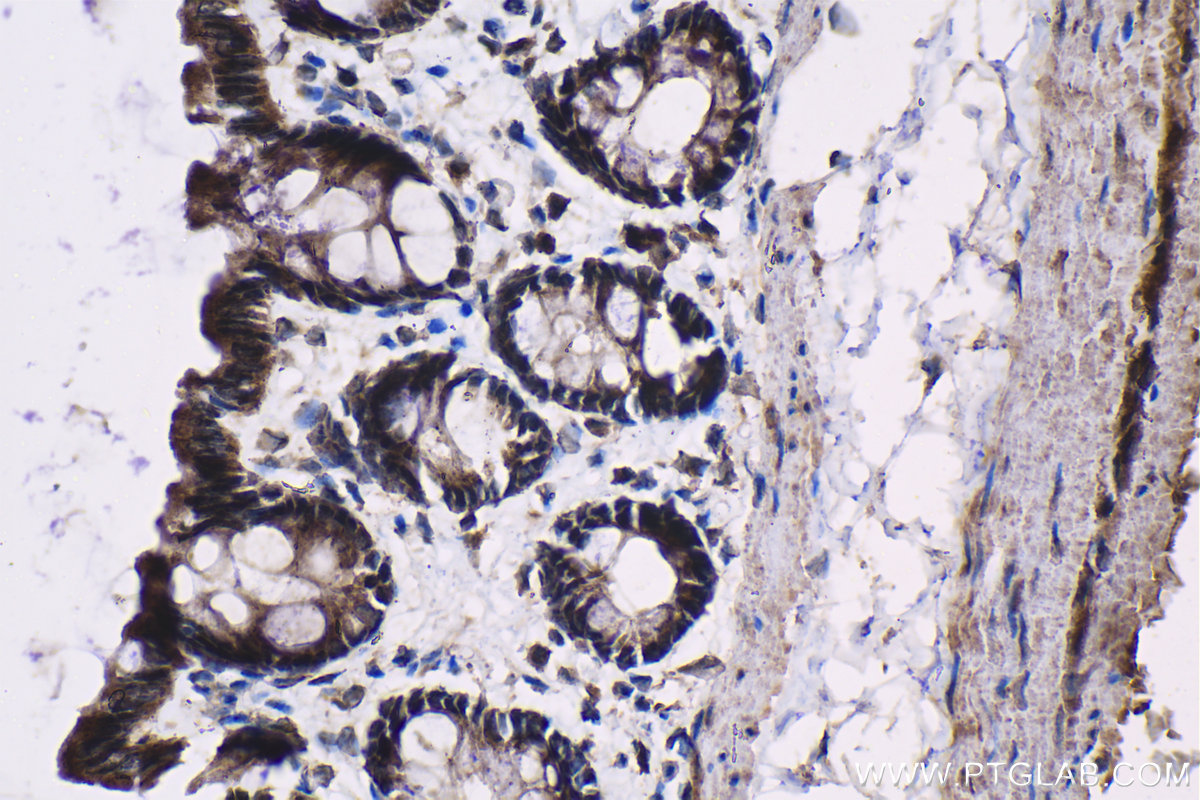 Immunohistochemical analysis of paraffin-embedded rat colon tissue slide using KHC1333 (IGFBP2 IHC Kit).