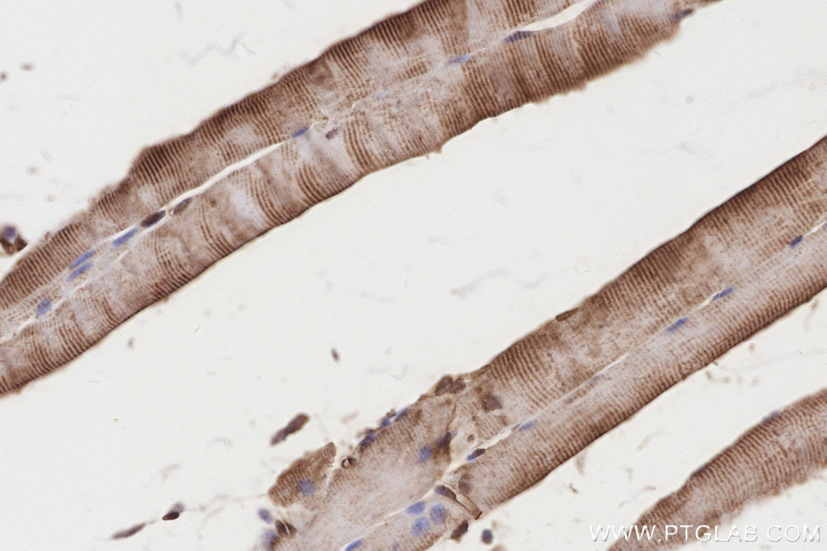 Immunohistochemical analysis of paraffin-embedded mouse skeletal muscle tissue slide using KHC3201 (IGFBP5 IHC Kit).