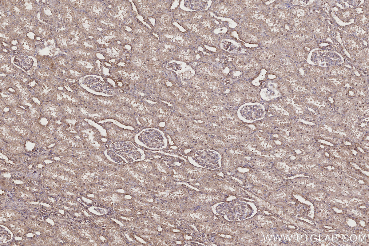 Immunohistochemical analysis of paraffin-embedded human kidney tissue slide using KHC3201 (IGFBP5 IHC Kit).