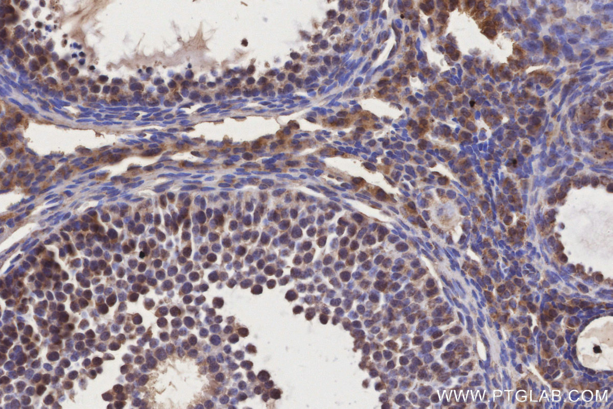 Immunohistochemical analysis of paraffin-embedded mouse ovary tissue slide using KHC3201 (IGFBP5 IHC Kit).