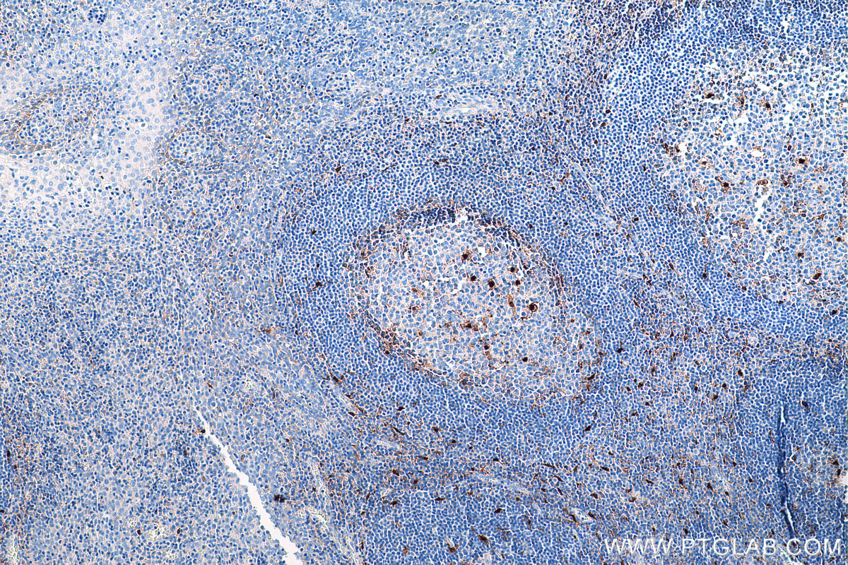 Immunohistochemical analysis of paraffin-embedded human tonsillitis tissue slide using KHC0308 (IL18 IHC Kit).