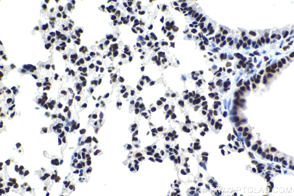 Immunohistochemical analysis of paraffin-embedded mouse lung tissue slide using KHC1695 (ILF3 IHC Kit).