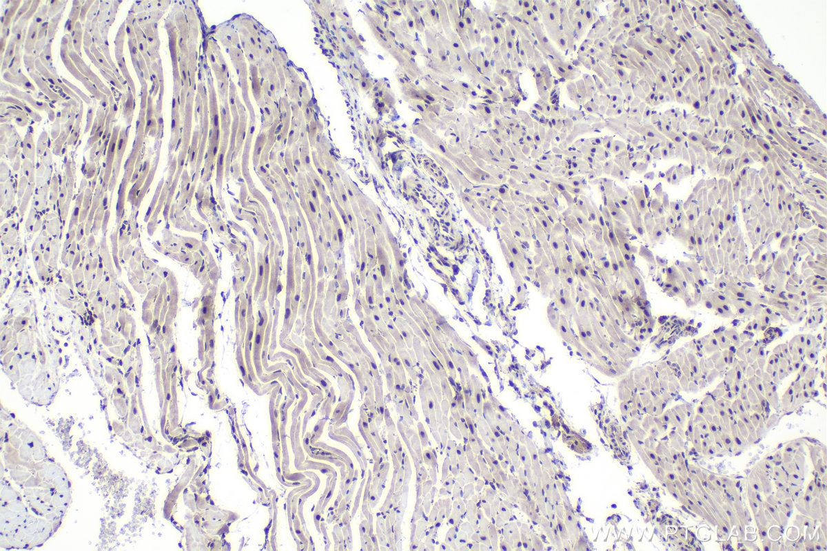 Immunohistochemical analysis of paraffin-embedded rat heart tissue slide using KHC1022 (ILKAP IHC Kit).