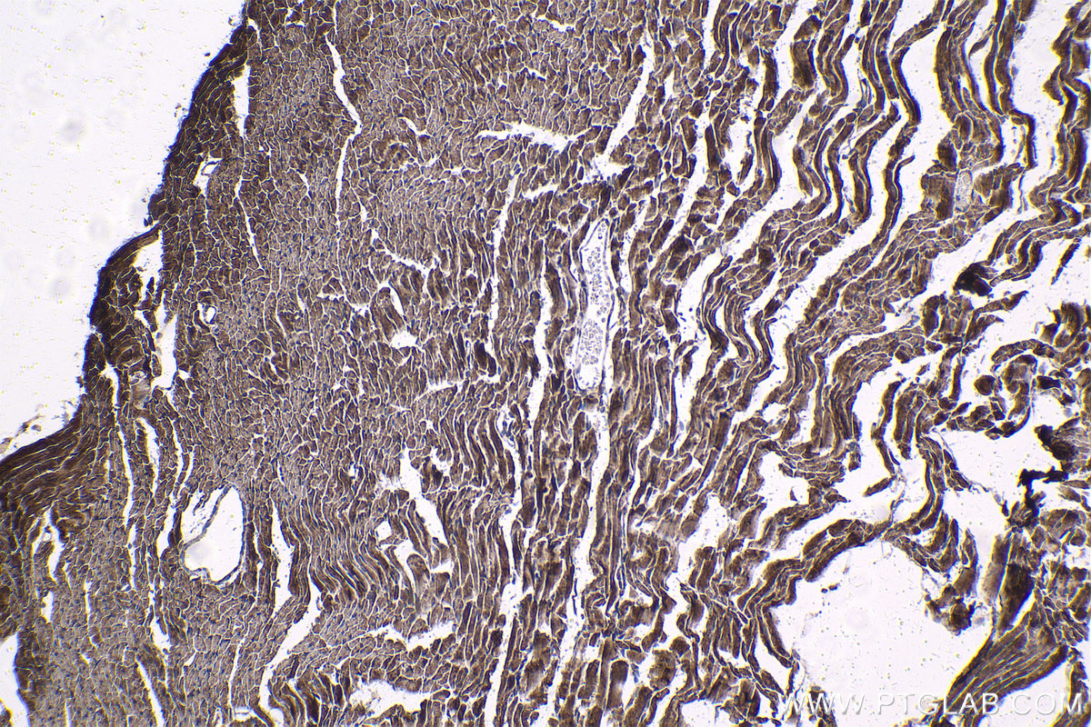 Immunohistochemical analysis of paraffin-embedded mouse heart tissue slide using KHC1362 (IMMT IHC Kit).