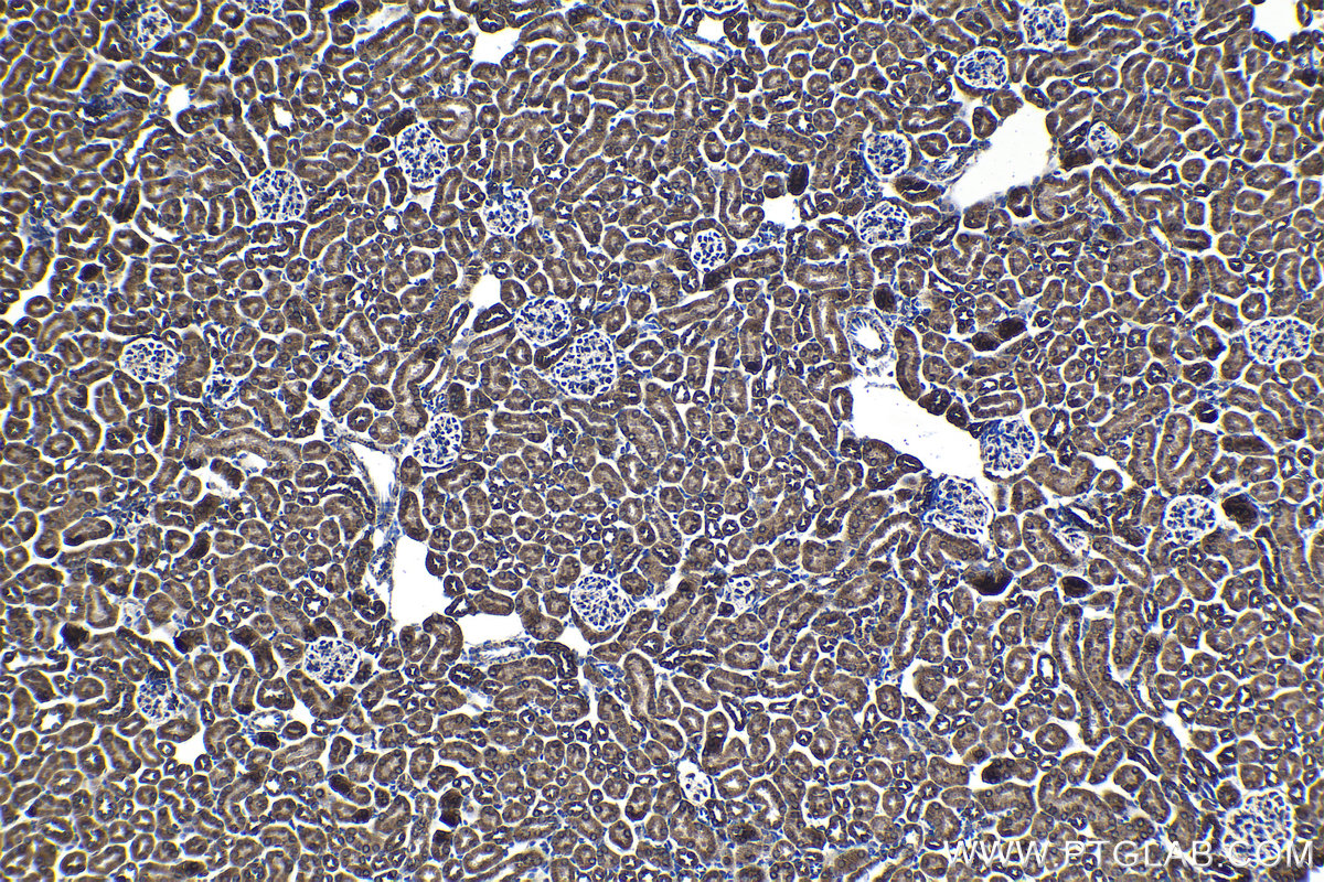 Immunohistochemical analysis of paraffin-embedded mouse kidney tissue slide using KHC1362 (IMMT IHC Kit).