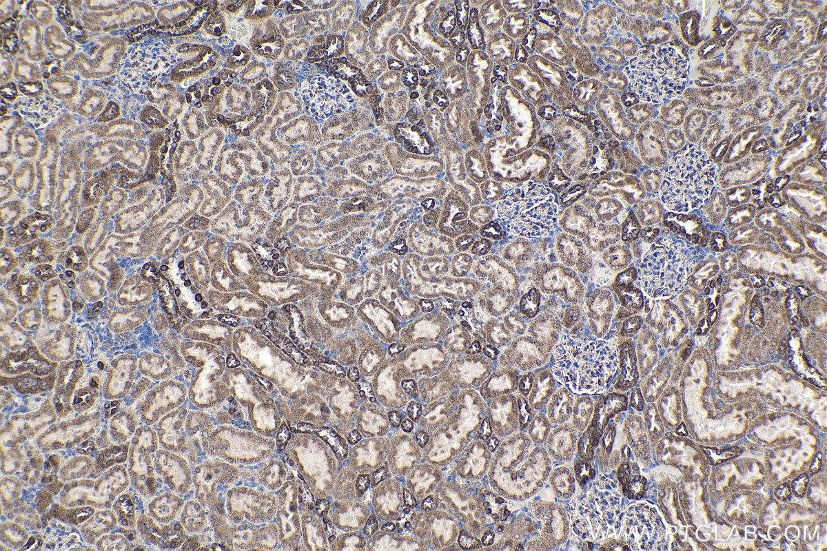 Immunohistochemical analysis of paraffin-embedded rat kidney tissue slide using KHC1362 (IMMT IHC Kit).