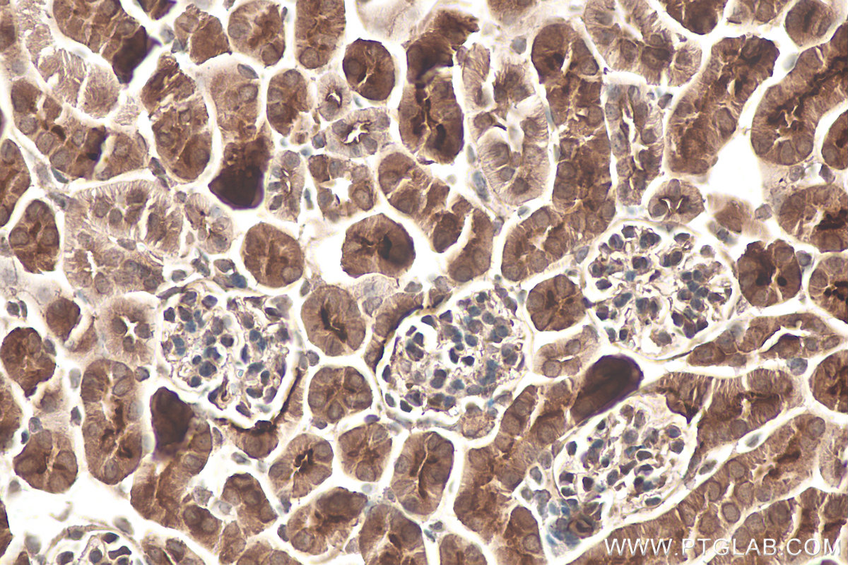 Immunohistochemical analysis of paraffin-embedded mouse kidney tissue slide using KHC0911 (IMPDH1 IHC Kit).