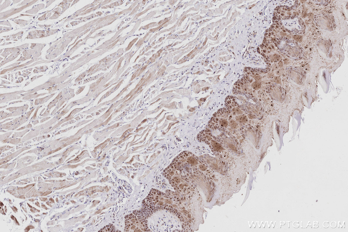 Immunohistochemical analysis of paraffin-embedded rat tongue tissue slide using KHC3035 (INO80 IHC Kit). Immunohistochemical analysis of paraffin-embedded rat tongue tissue slide using KHC3035 (INO80 IHC Kit).