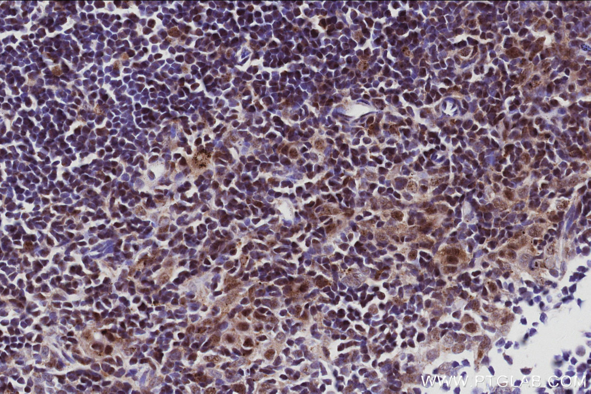 Immunohistochemical analysis of paraffin-embedded mouse thymus tissue slide using KHC3035 (INO80 IHC Kit). Immunohistochemical analysis of paraffin-embedded mouse thymus tissue slide using KHC3035 (INO80 IHC Kit).