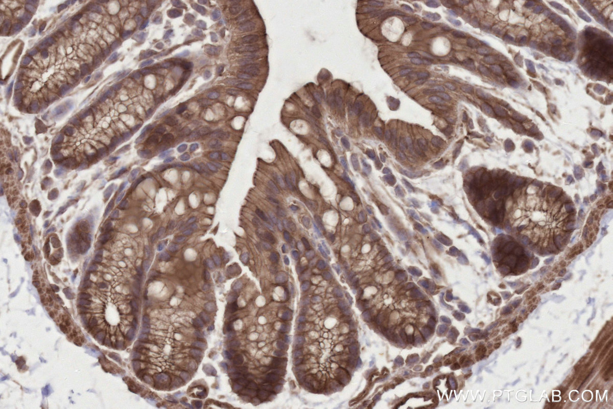 Immunohistochemical analysis of paraffin-embedded mouse colon tissue slide using KHC2813 (INPP4A IHC Kit).