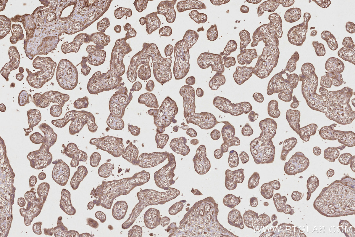 Immunohistochemical analysis of paraffin-embedded human placenta tissue slide using KHC2813 (INPP4A IHC Kit).