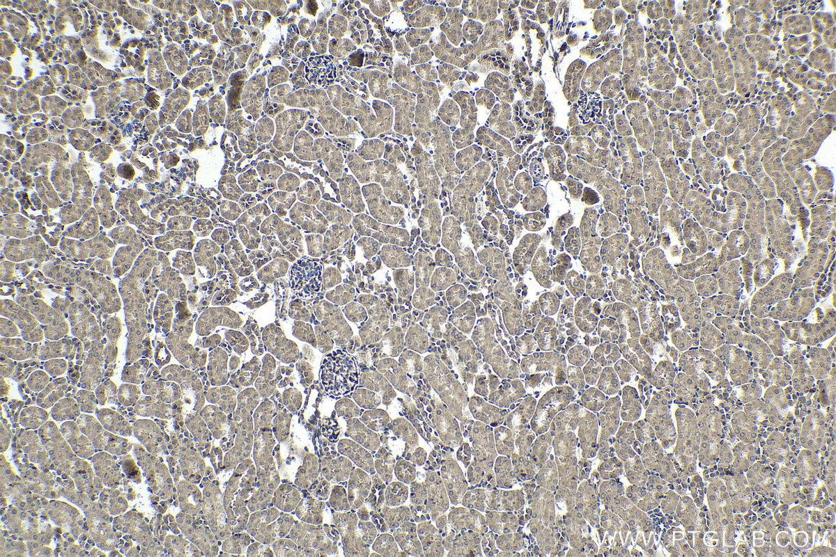 Immunohistochemical analysis of paraffin-embedded mouse kidney tissue slide using KHC1902 (INPP5K IHC Kit).