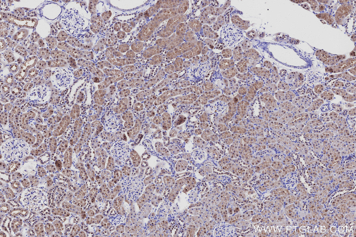 Immunohistochemical analysis of paraffin-embedded rat kidney tissue slide using KHC3111 (INSM2 IHC Kit). Immunohistochemical analysis of paraffin-embedded rat kidney tissue slide using KHC3111 (INSM2 IHC Kit).