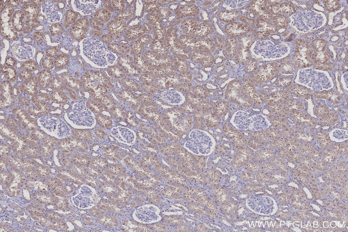 Immunohistochemical analysis of paraffin-embedded human kidney tissue slide using KHC3111 (INSM2 IHC Kit). Immunohistochemical analysis of paraffin-embedded human kidney tissue slide using KHC3111 (INSM2 IHC Kit).