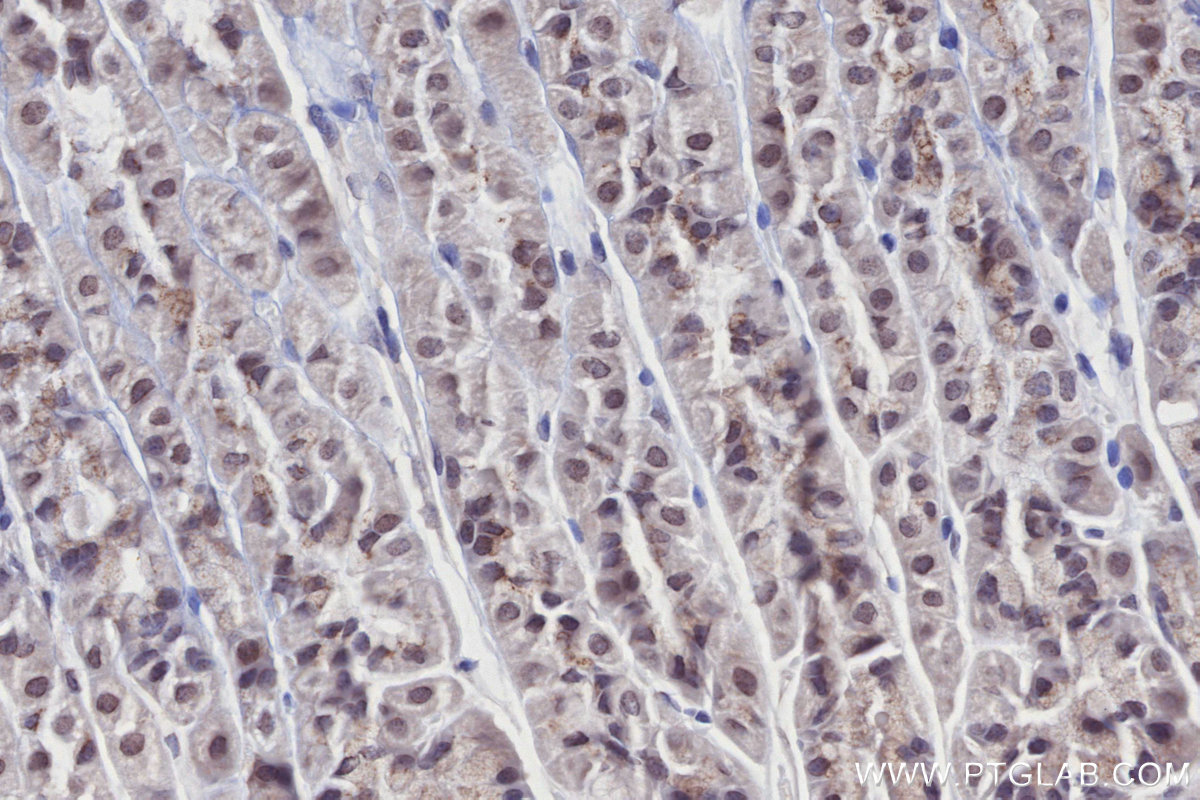 Immunohistochemical analysis of paraffin-embedded mouse stomach tissue slide using KHC2698 (IPMK IHC Kit).