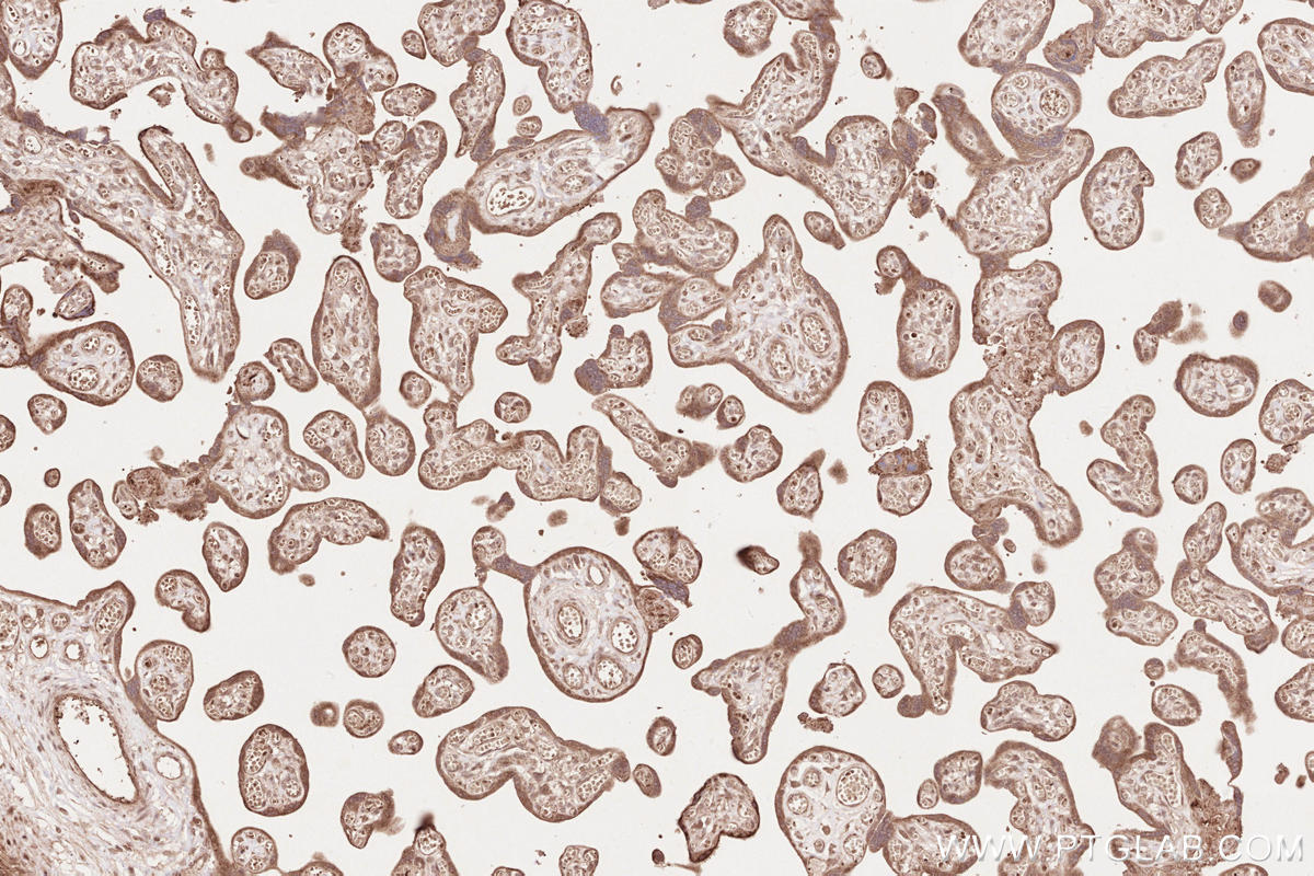 Immunohistochemical analysis of paraffin-embedded human placenta tissue slide using KHC2636 (IQGAP3 IHC Kit).