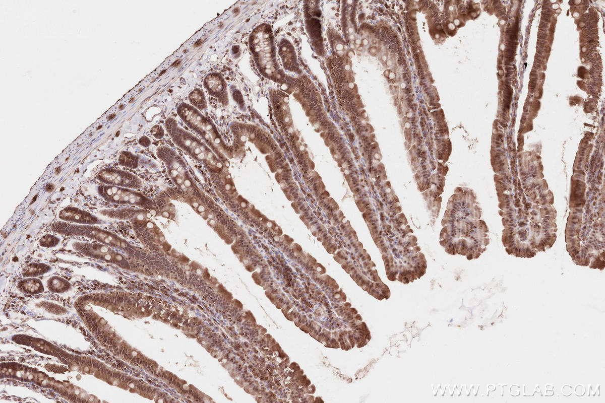 Immunohistochemical analysis of paraffin-embedded rat small intestine tissue slide using KHC2636 (IQGAP3 IHC Kit).