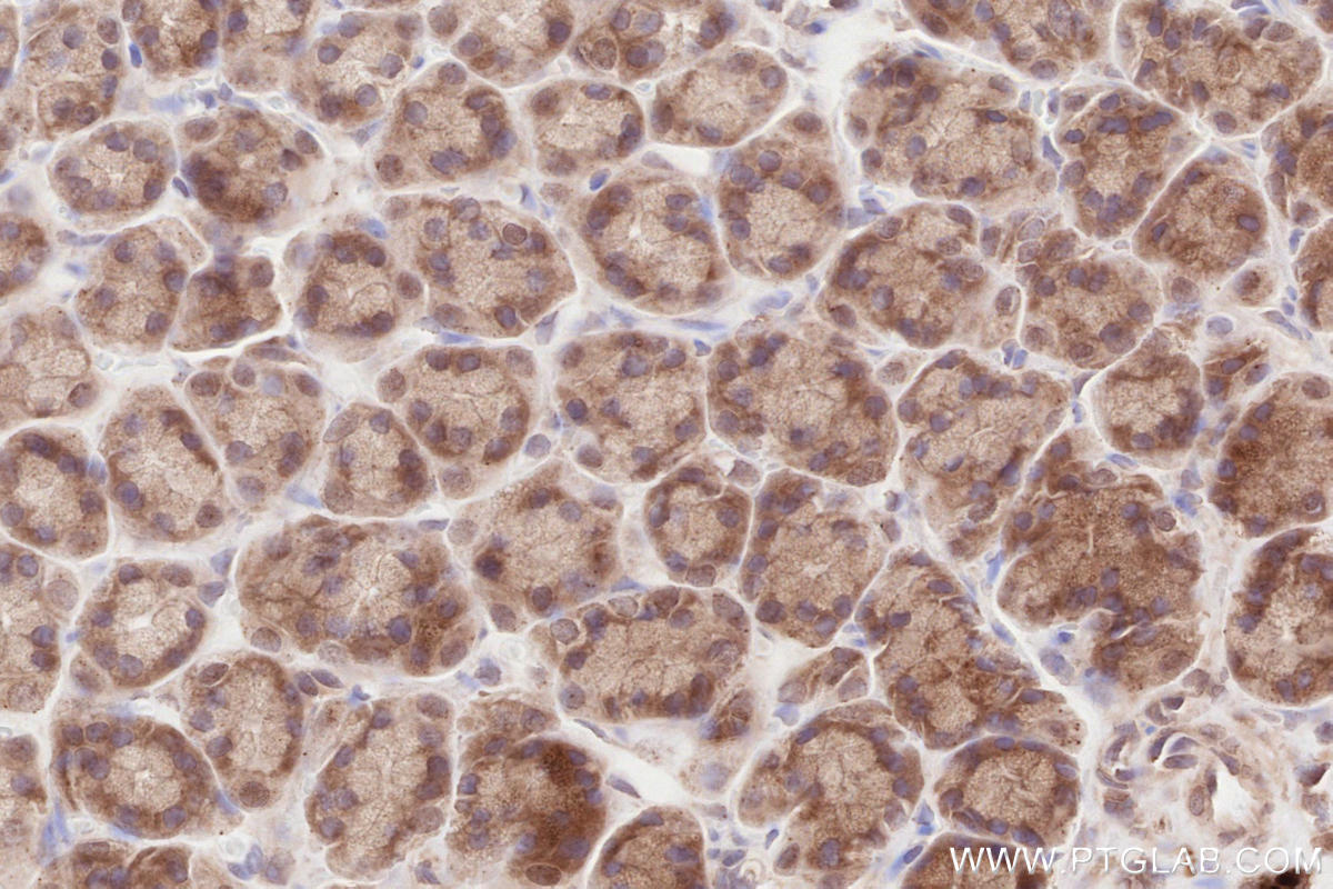 Immunohistochemical analysis of paraffin-embedded rat stomach tissue slide using KHC2636 (IQGAP3 IHC Kit).