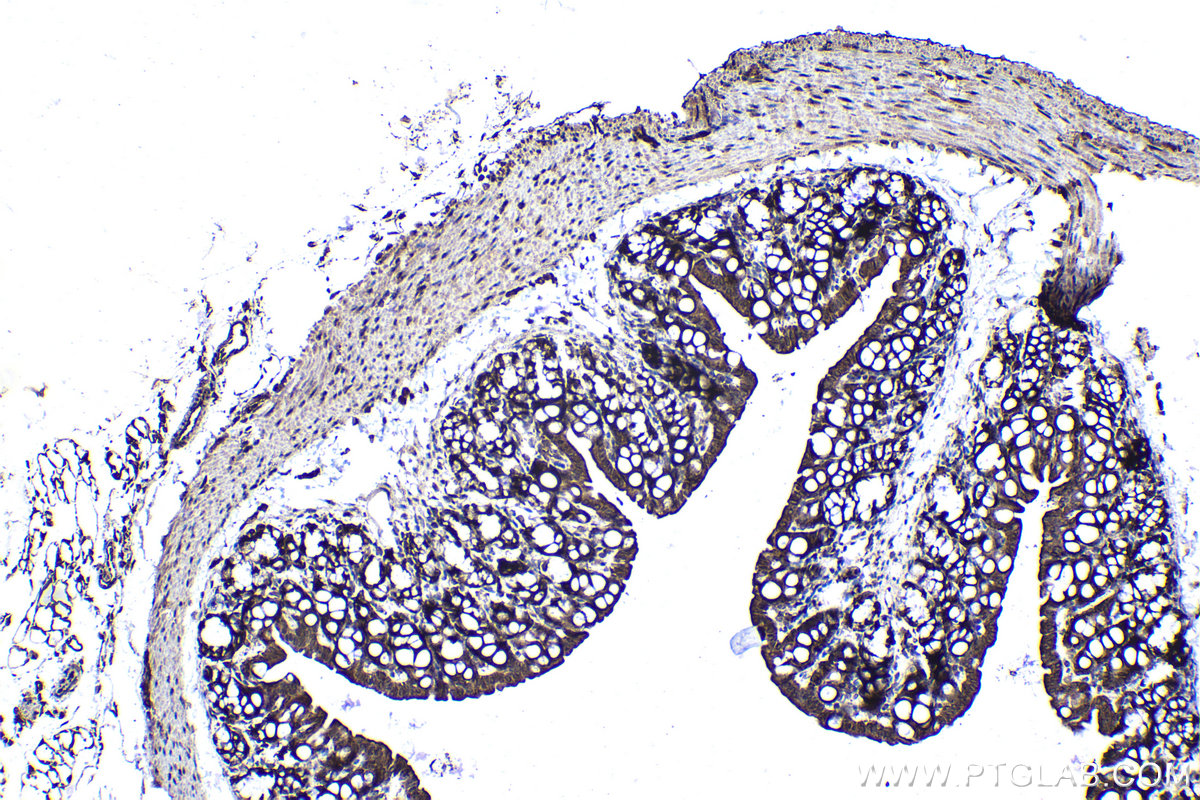 Immunohistochemical analysis of paraffin-embedded mouse colon tissue slide using KHC1136 (IRAK3 IHC Kit).