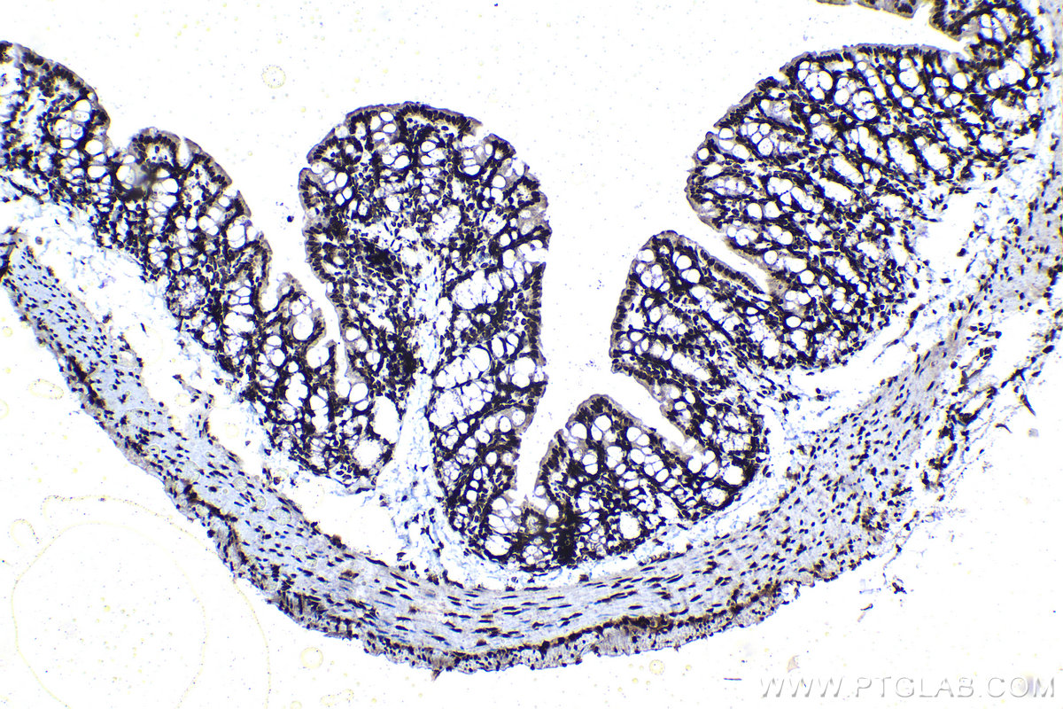 Immunohistochemical analysis of paraffin-embedded mouse colon tissue slide using KHC1137 (IRF3 IHC Kit).