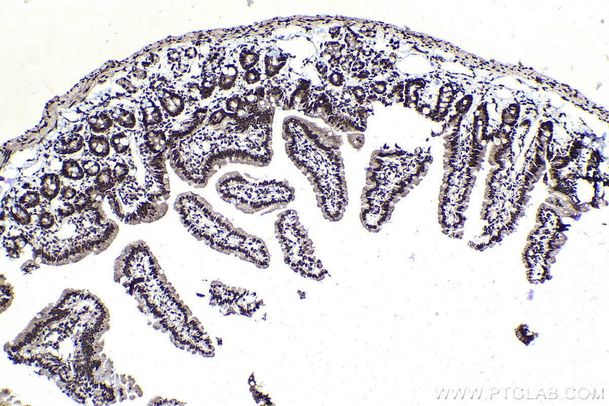 Immunohistochemical analysis of paraffin-embedded mouse small intestine tissue slide using KHC1137 (IRF3 IHC Kit).