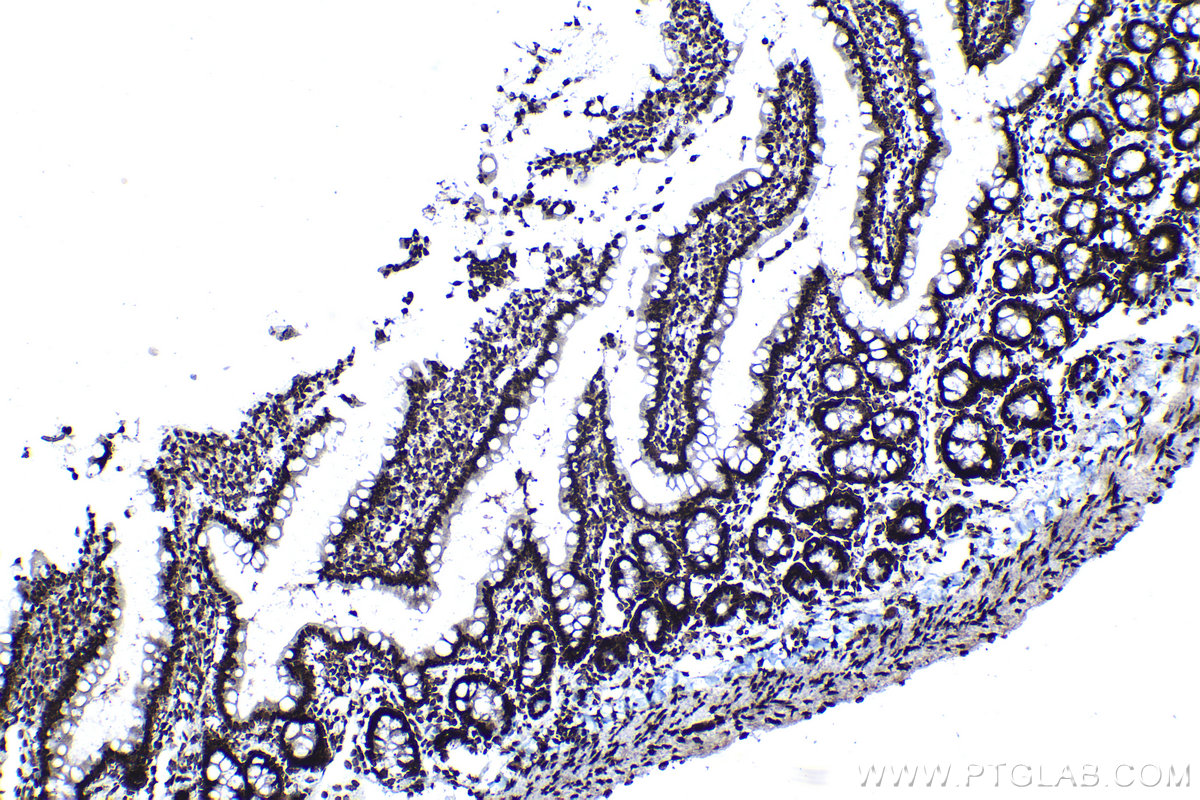 Immunohistochemical analysis of paraffin-embedded rat small intestine tissue slide using KHC1137 (IRF3 IHC Kit).