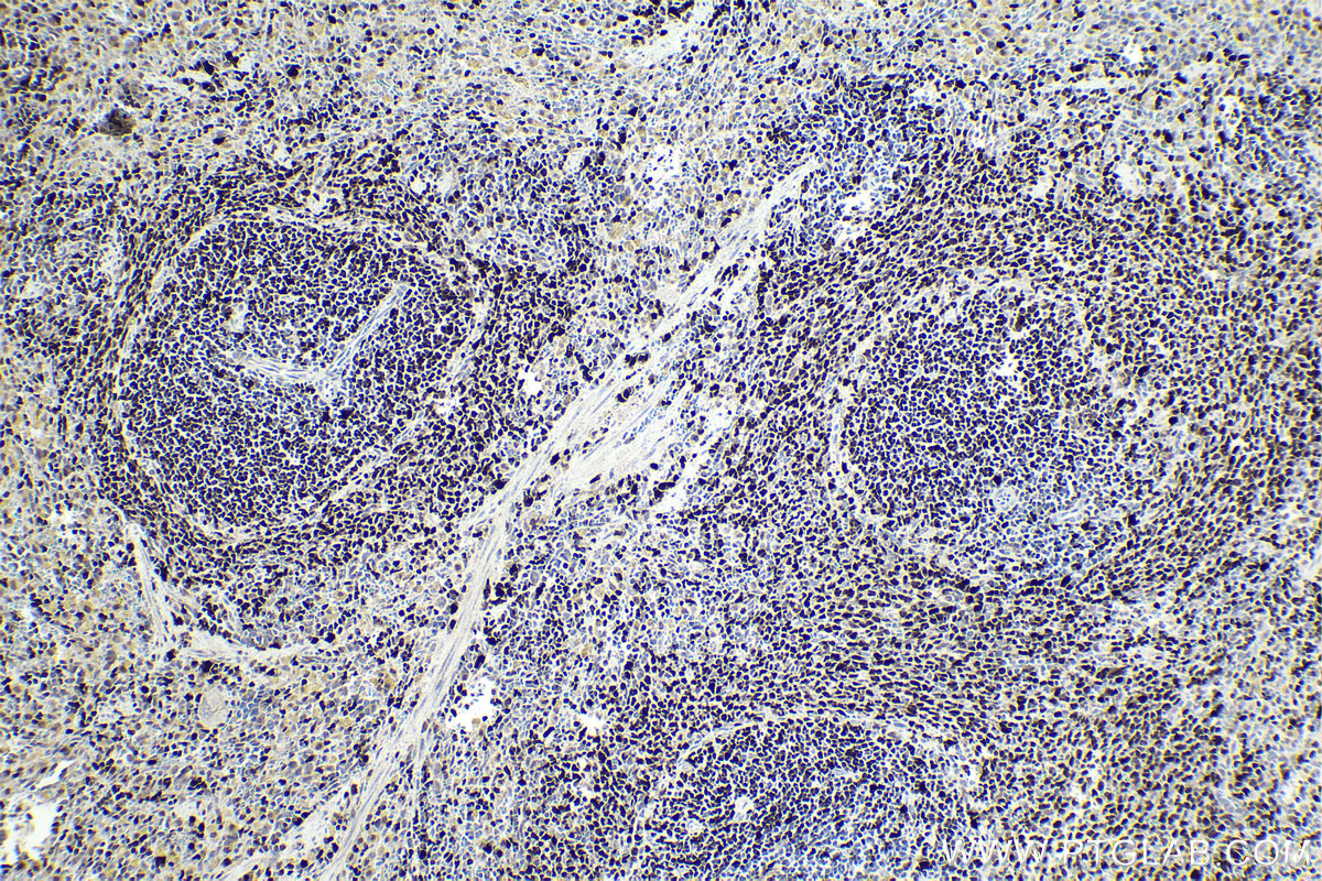 Immunohistochemical analysis of paraffin-embedded rat spleen tissue slide using KHC1749 (IRF4 IHC Kit).