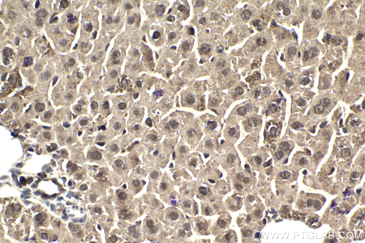 Immunohistochemical analysis of paraffin-embedded mouse liver tissue slide using KHC1861 (IRF7 IHC Kit).