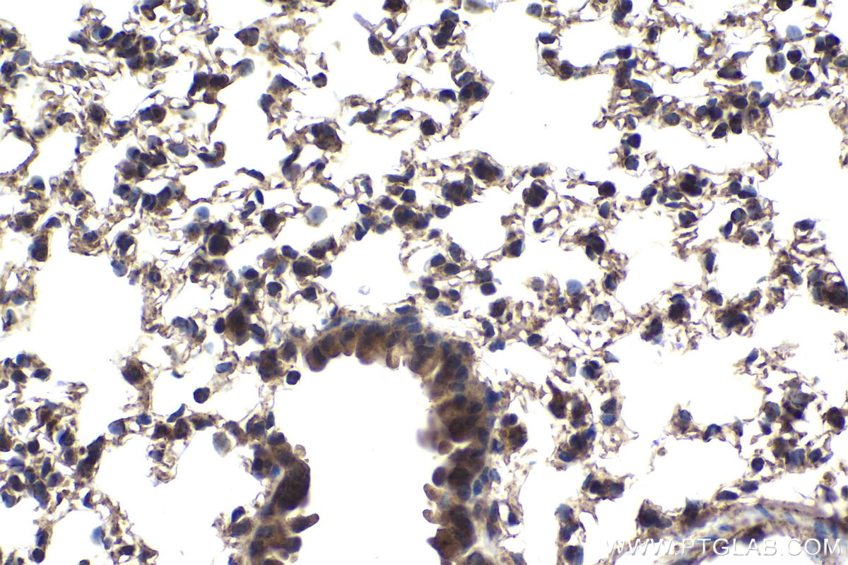 Immunohistochemical analysis of paraffin-embedded mouse lung tissue slide using KHC1861 (IRF7 IHC Kit).