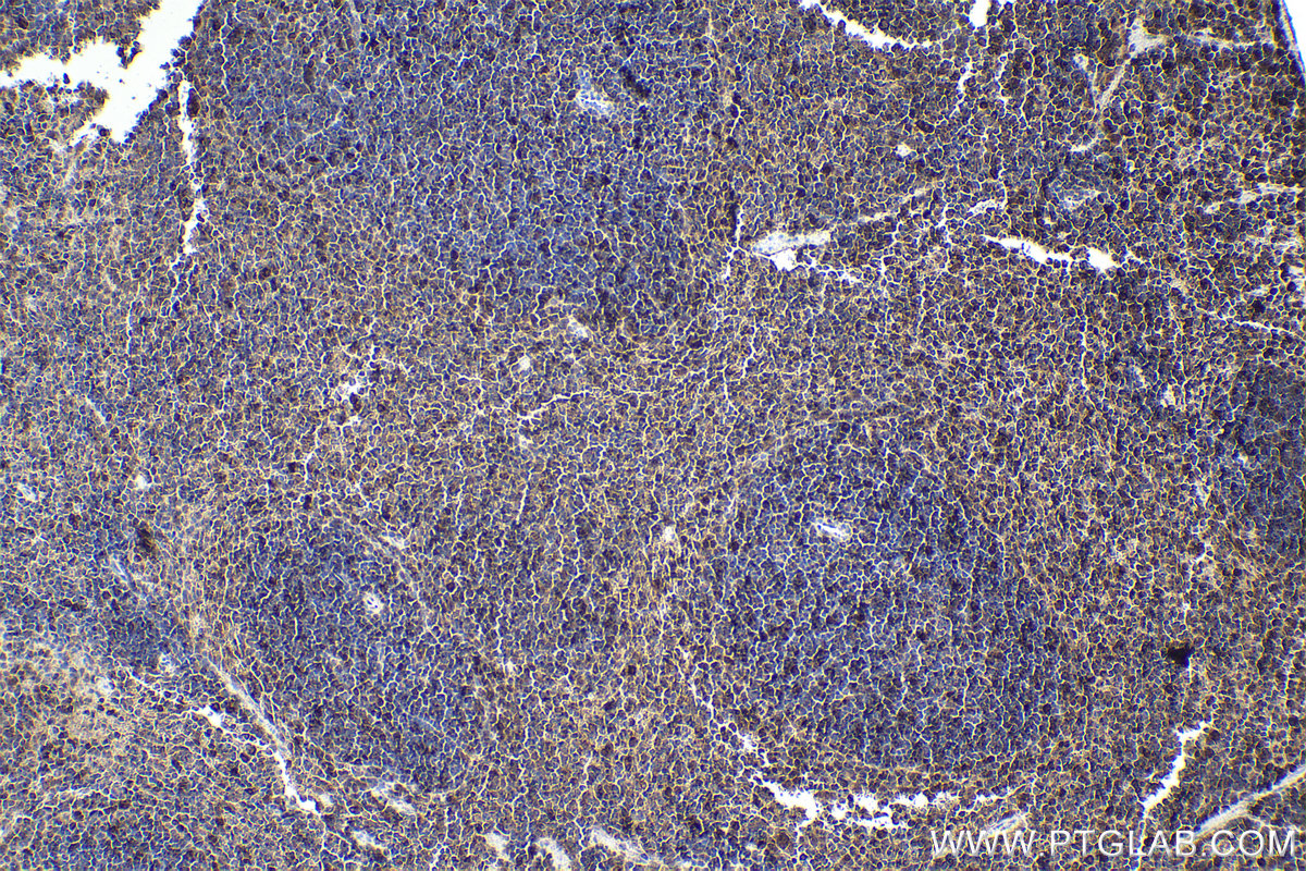 Immunohistochemical analysis of paraffin-embedded mouse spleen tissue slide using KHC1861 (IRF7 IHC Kit).