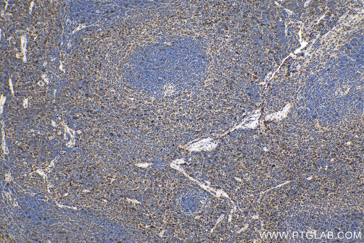 Immunohistochemical analysis of paraffin-embedded mouse spleen tissue slide using KHC1660 (IRF9 IHC Kit).