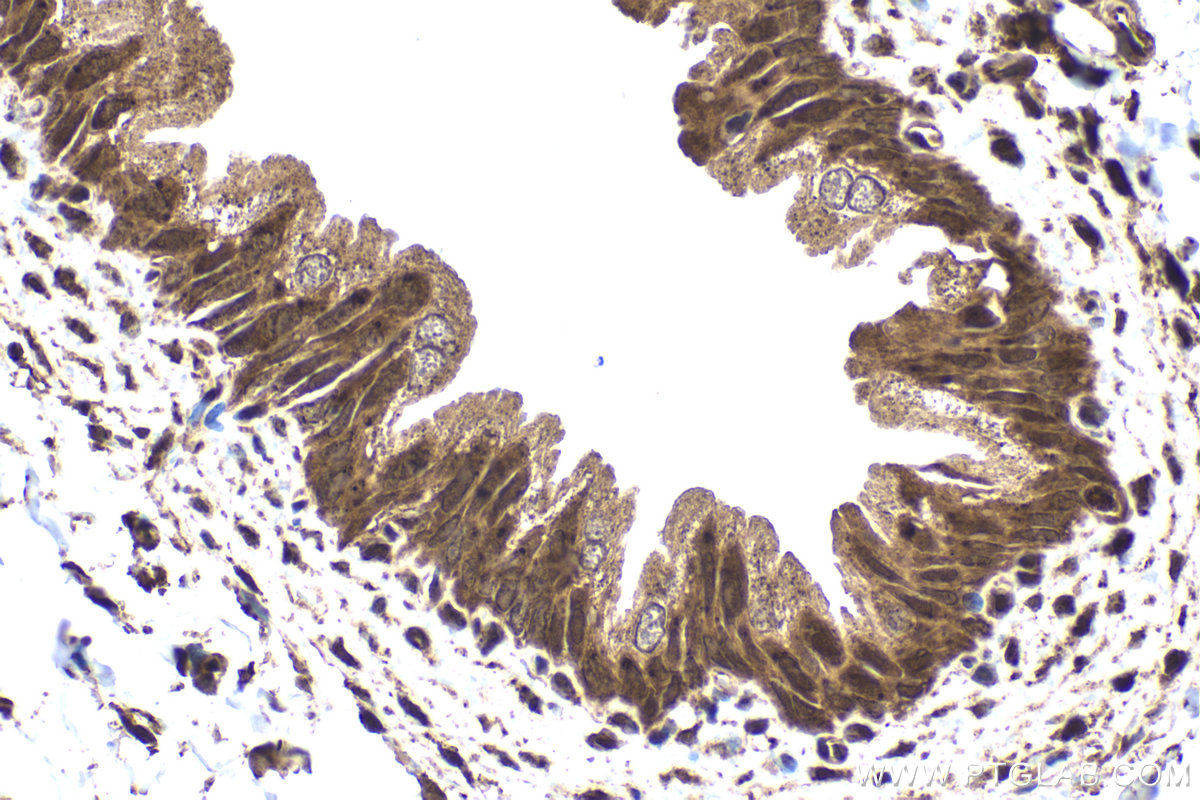 Immunohistochemical analysis of paraffin-embedded rat bladder tissue slide using KHC1660 (IRF9 IHC Kit).