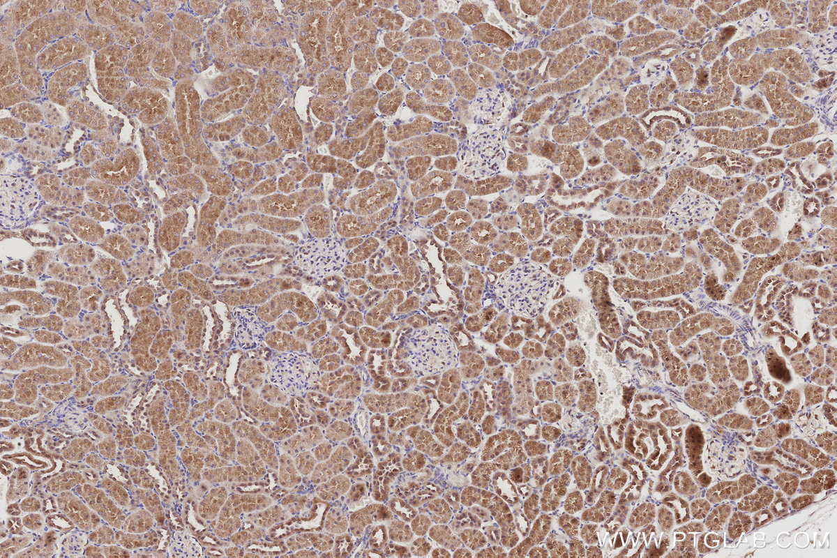 Immunohistochemical analysis of paraffin-embedded rat kidney tissue slide using KHC3049 (IRSp53 IHC Kit). Immunohistochemical analysis of paraffin-embedded rat kidney tissue slide using KHC3049 (IRSp53 IHC Kit).