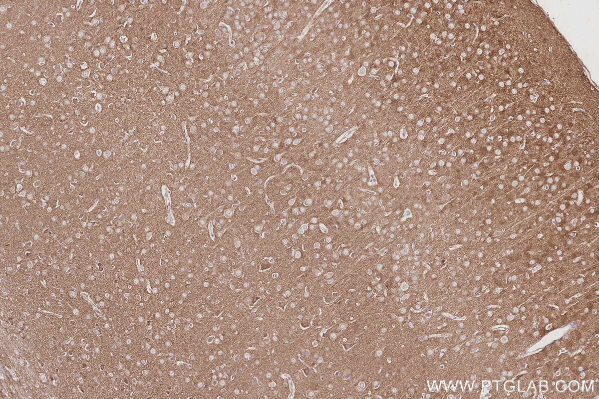 Immunohistochemical analysis of paraffin-embedded rat brain tissue slide using KHC3049 (IRSp53 IHC Kit). Immunohistochemical analysis of paraffin-embedded rat brain tissue slide using KHC3049 (IRSp53 IHC Kit).
