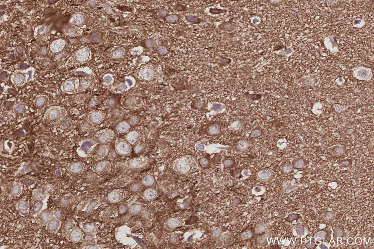 Immunohistochemical analysis of paraffin-embedded mouse brain tissue slide using KHC3049 (IRSp53 IHC Kit). Immunohistochemical analysis of paraffin-embedded mouse brain tissue slide using KHC3049 (IRSp53 IHC Kit).