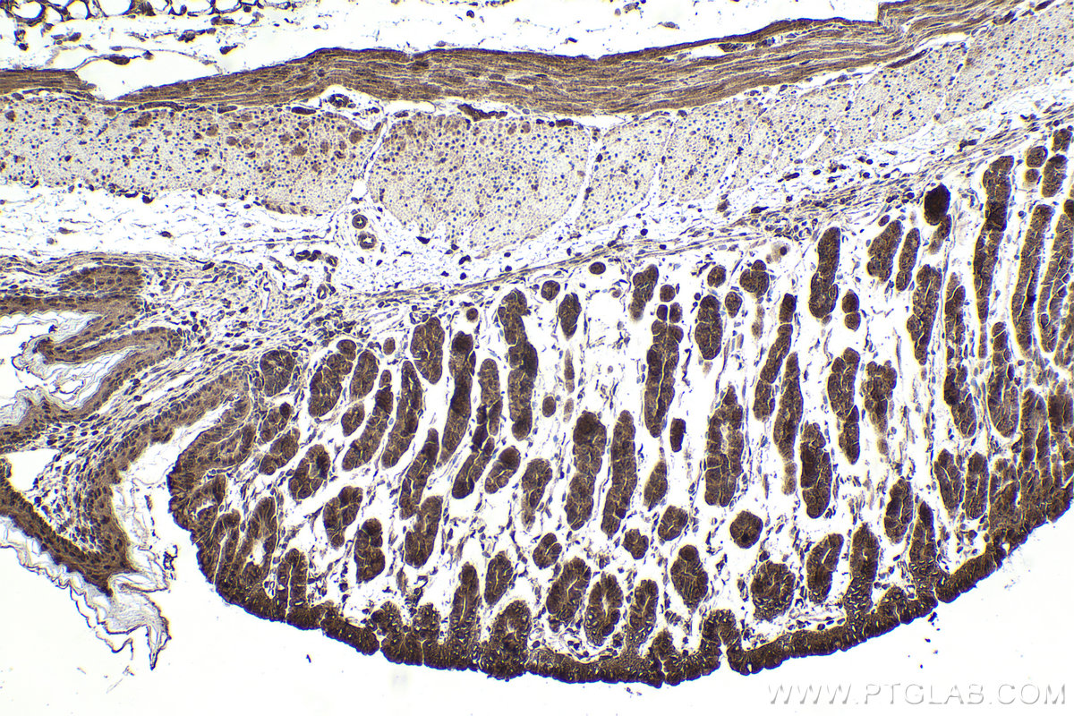 Immunohistochemical analysis of paraffin-embedded mouse stomach tissue slide using KHC1875 (ITCH IHC Kit).