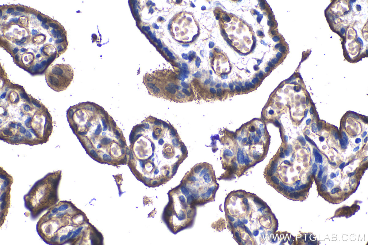 Immunohistochemical analysis of paraffin-embedded human placenta tissue slide using KHC1228 (ITGA5 IHC Kit).