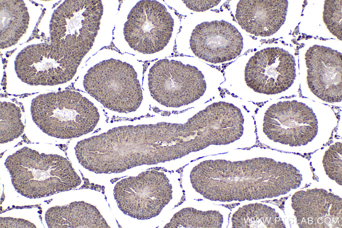 Immunohistochemical analysis of paraffin-embedded rat testis tissue slide using KHC1711 (ITGB3BP IHC Kit).