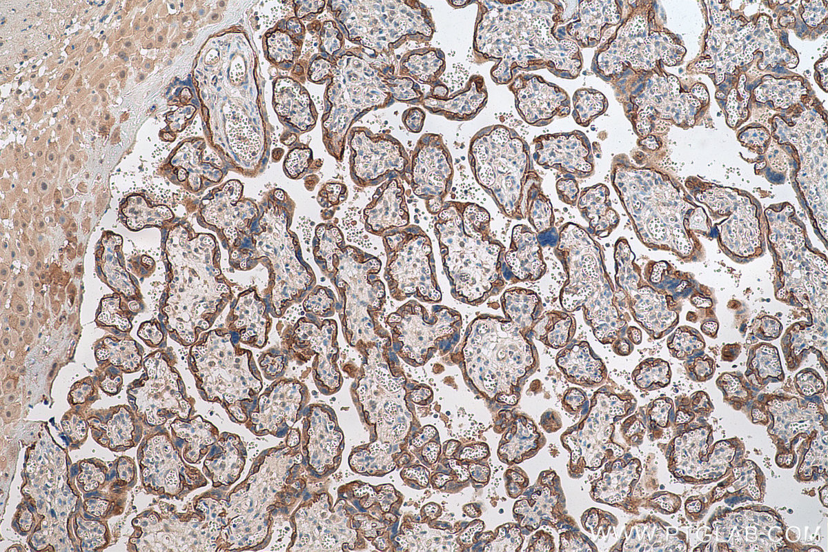 Immunohistochemical analysis of paraffin-embedded human placenta tissue slide using KHC0800 (ITGB4 IHC Kit).