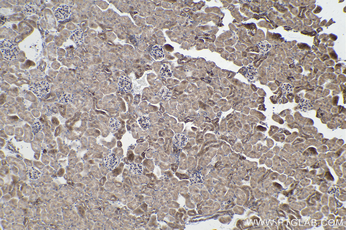 Immunohistochemical analysis of paraffin-embedded mouse kidney tissue slide using KHC0221 (Integrin Beta 6 IHC Kit).